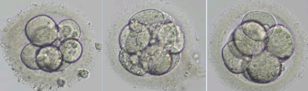 卵子ドナー使用受精卵に着床前診断は必要か（よく聞かれる質問）